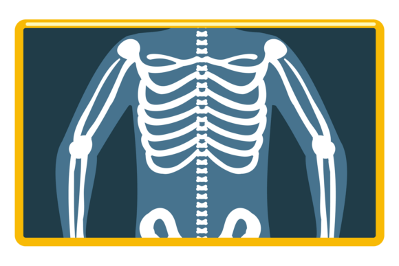 X-ray Chest Picture. Medical Skeleton Di